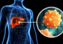 Indonesia Catat 1,4 Juta Kematian per Tahun Akibat Hepatitis